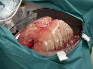Заокн о транспланталогии